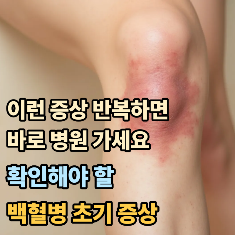 "이런 증상 반복하면 바로 병원 가세요"...눈 여겨 볼 백혈병 초기증상