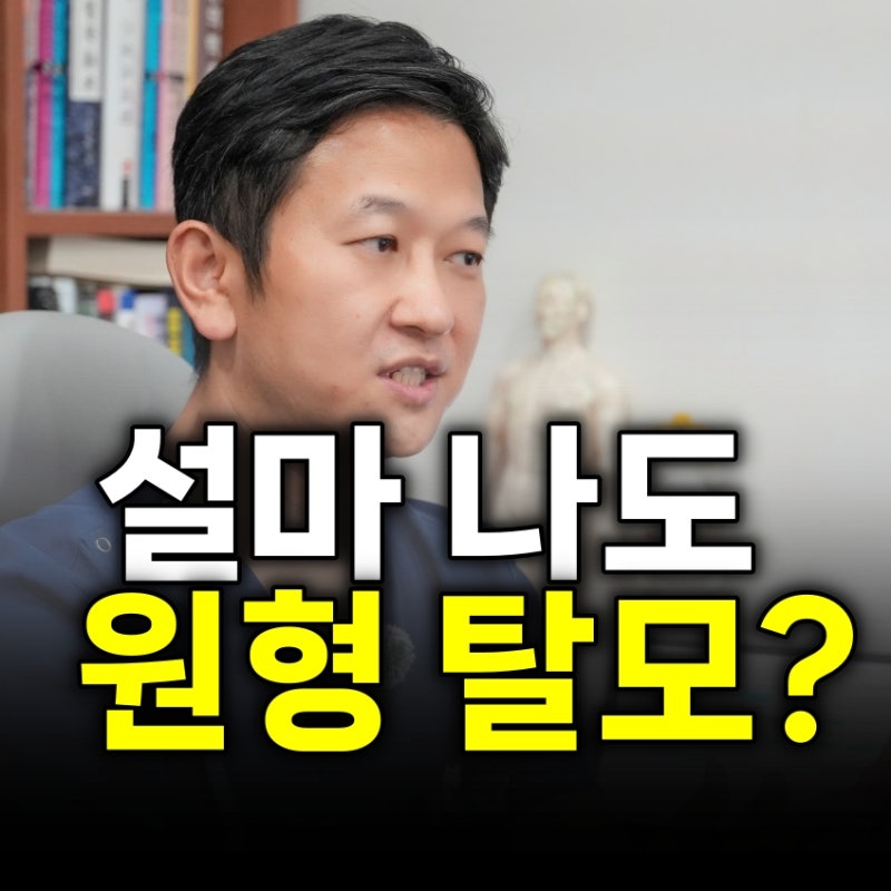 스트레스성 원형 탈모 초기증상과 원인 알아봐요