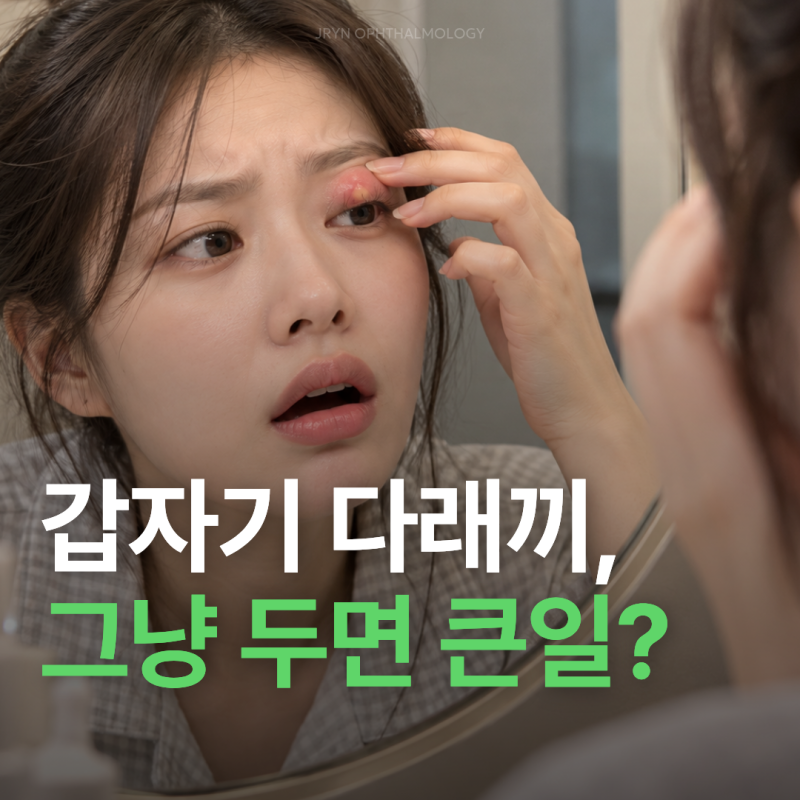 서면안과 갑자기 눈이 욱씬? 다래끼치료 알아보기
