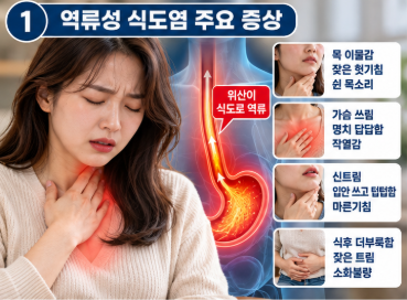역류성 식도염 증상 목 이물감 원인 약 복용 없이 완화하는 식습관 3가지