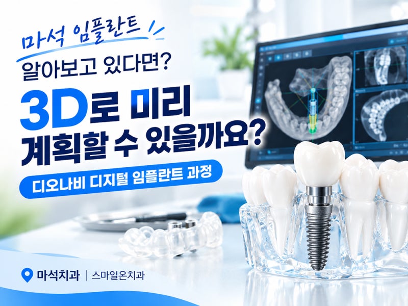 마석 임플란트 알아보고 있다면? 3D 디지털 임플란트 디오나비 과정｜마석치과