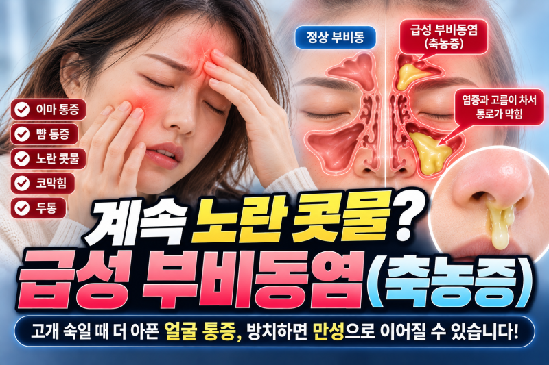 코가 막히고 노란 콧물과 얼굴 통증이 지속된다면? 급성 부비동염(축농증) 원인 & 자가진단 ....