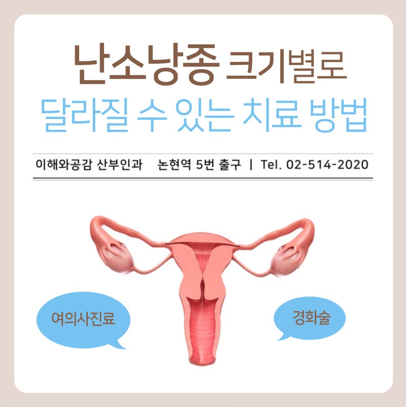 난소낭종 크기별로 달라질 수 있는 치료 방법