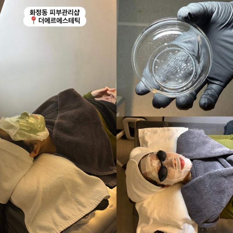 광주여드름관리 아쿠아필&수분재생관리 후기|압출잘하는 곳