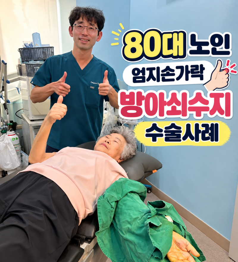 80대 노인 엄지손가락 방아쇠 수지 간단하게 수술하세요