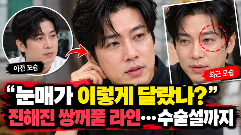 눈매가 이렇게 달랐나?” 손종원 확 달라진 모습에 ‘쌍꺼풀 수술설’까지