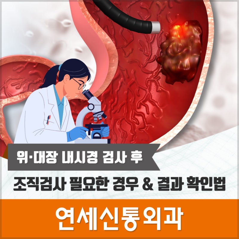[평촌 내시경 병원] 위·대장 내시경 검사 후 조직검사 필요한 경우 & 결과 확인법