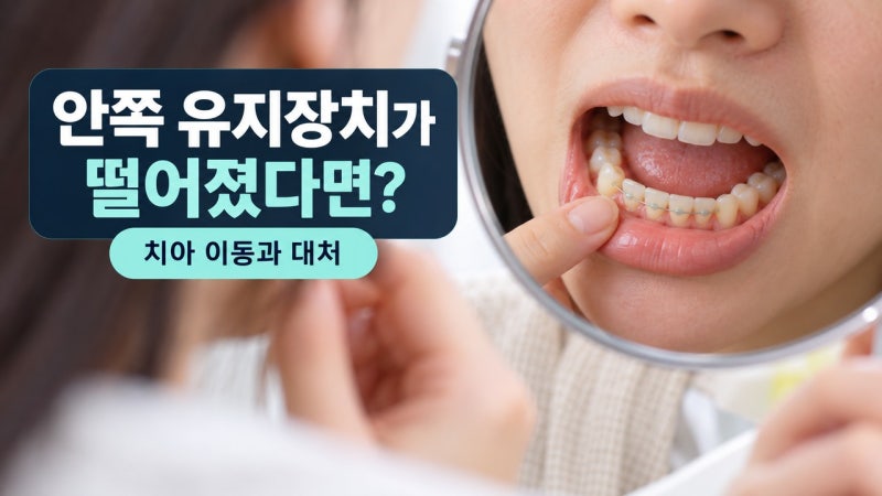 유지장치(안쪽 얇은 철사) 끊어지거나 떨어졌을 때 방치하면 치아 틀어지는 속도