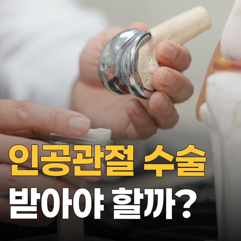 무릎 인공관절 수술, 수술 전 꼭 확인해야 할 5가지