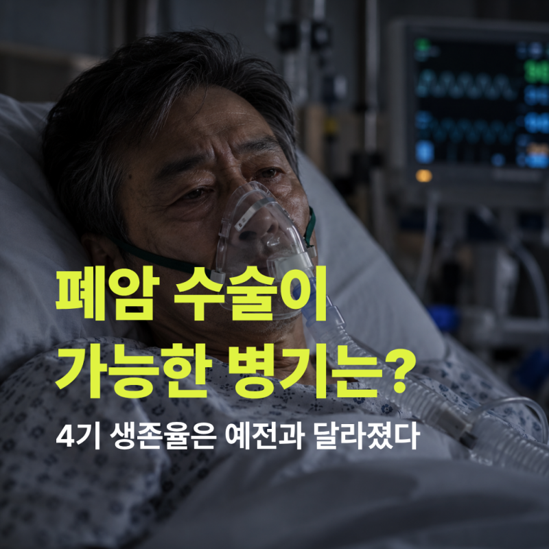 "폐암 수술 가능한 병기는?" 4기 생존율은 예전과 달라졌다