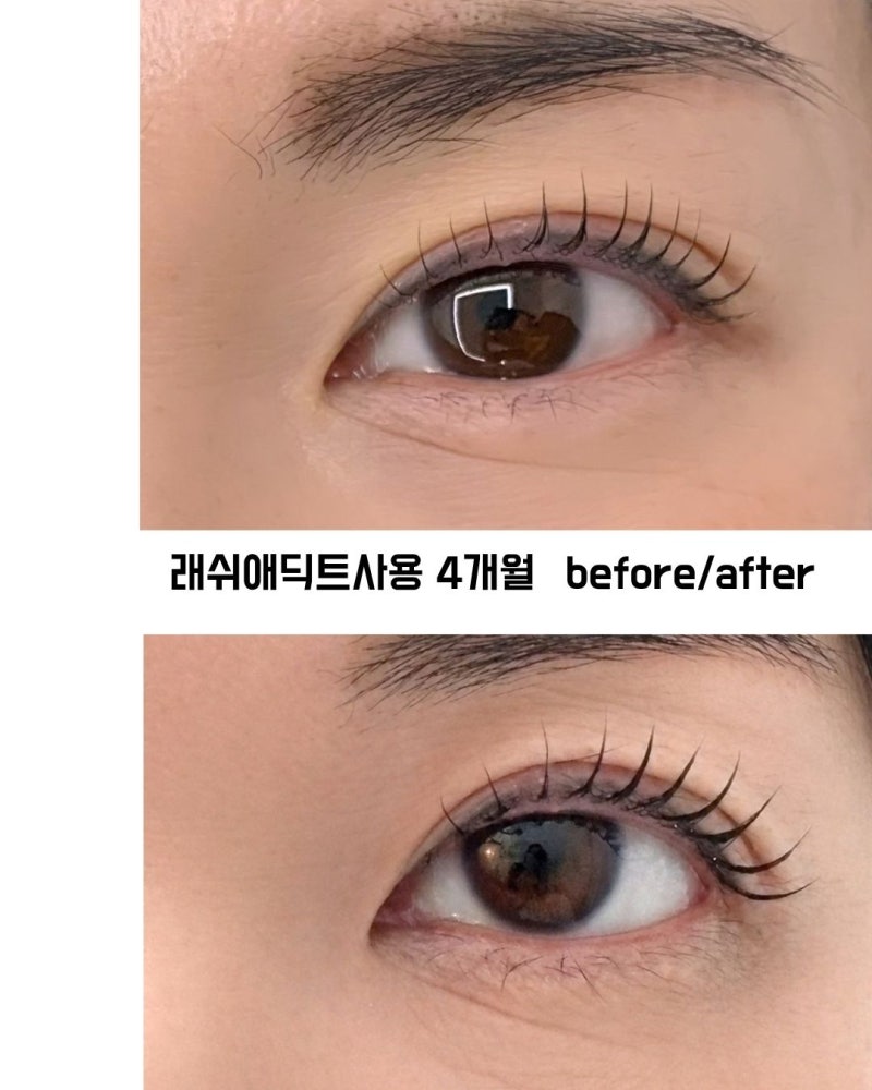 래쉬애딕트! 진짜 길어질까요?