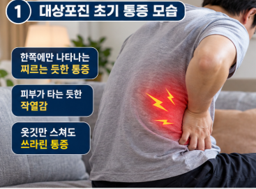 대상포진 초기증상 자가진단 통증 부위별 전조증상 골든타임 치료법 총정리