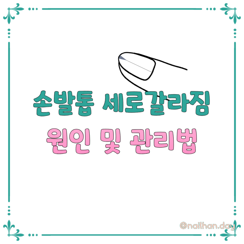 손톱 세로 갈라짐 원인은? 손톱이 갈라지는 이유와 젤네일 전 관리법