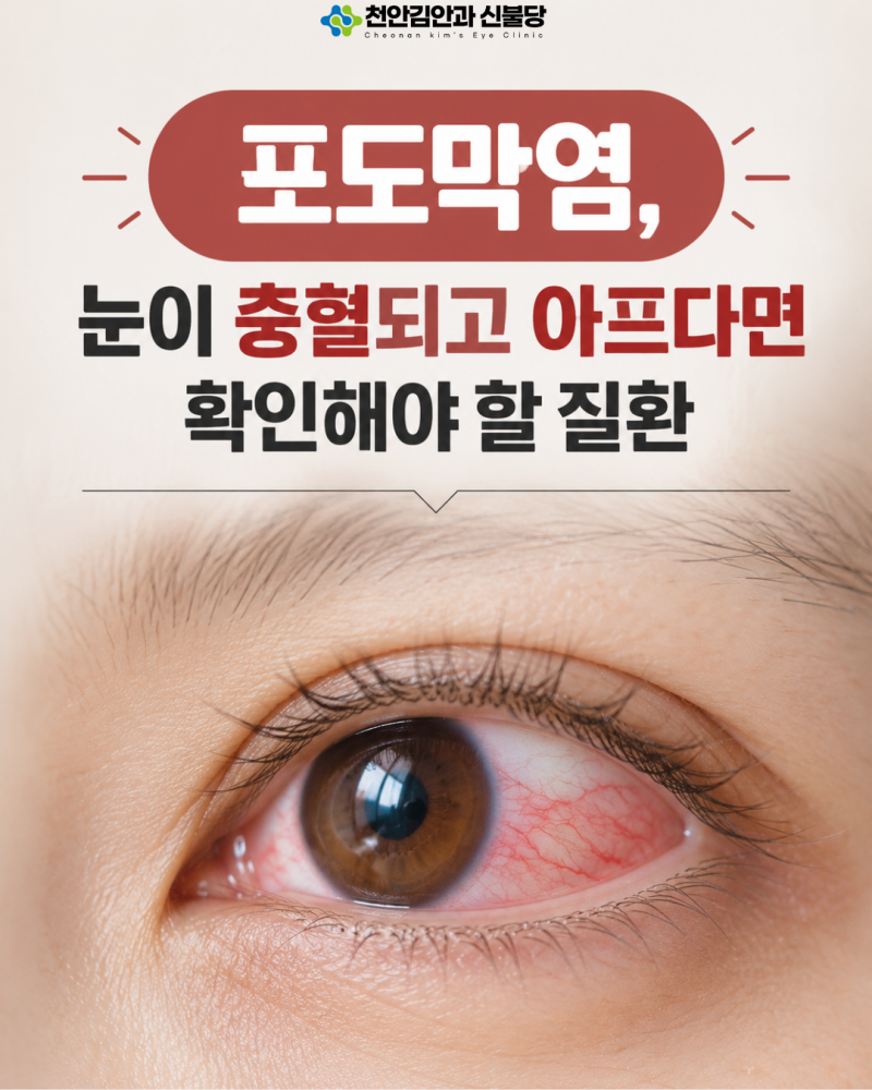 포도막염, 눈이 충혈되고 아프다면 확인해야 할 질환