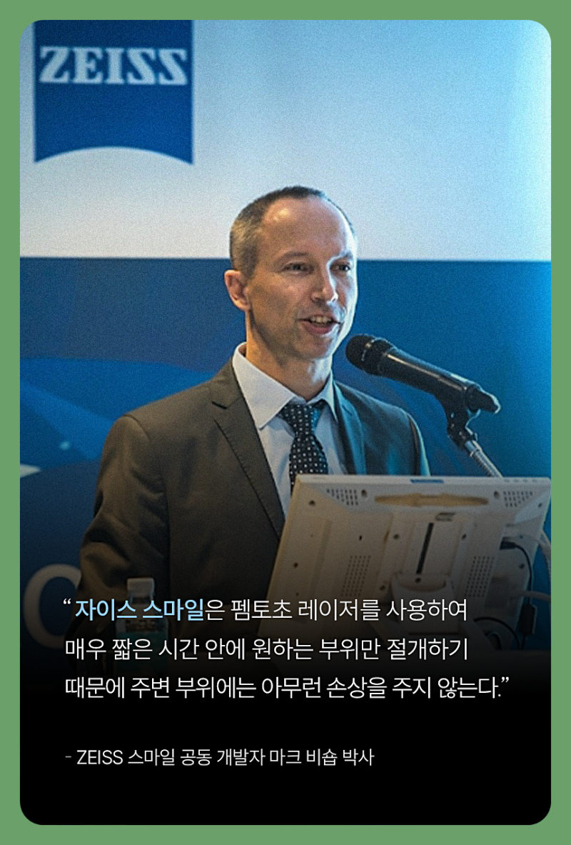 스마일라식후기, 시력과 회복기간을 비교할 때 확인할 5가지