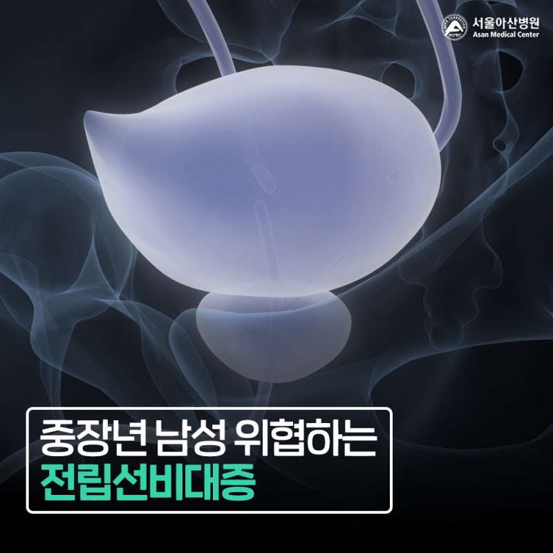 전립선이 크면 무조건 치료해야 할까? 전립선비대증 증상과 관리법
