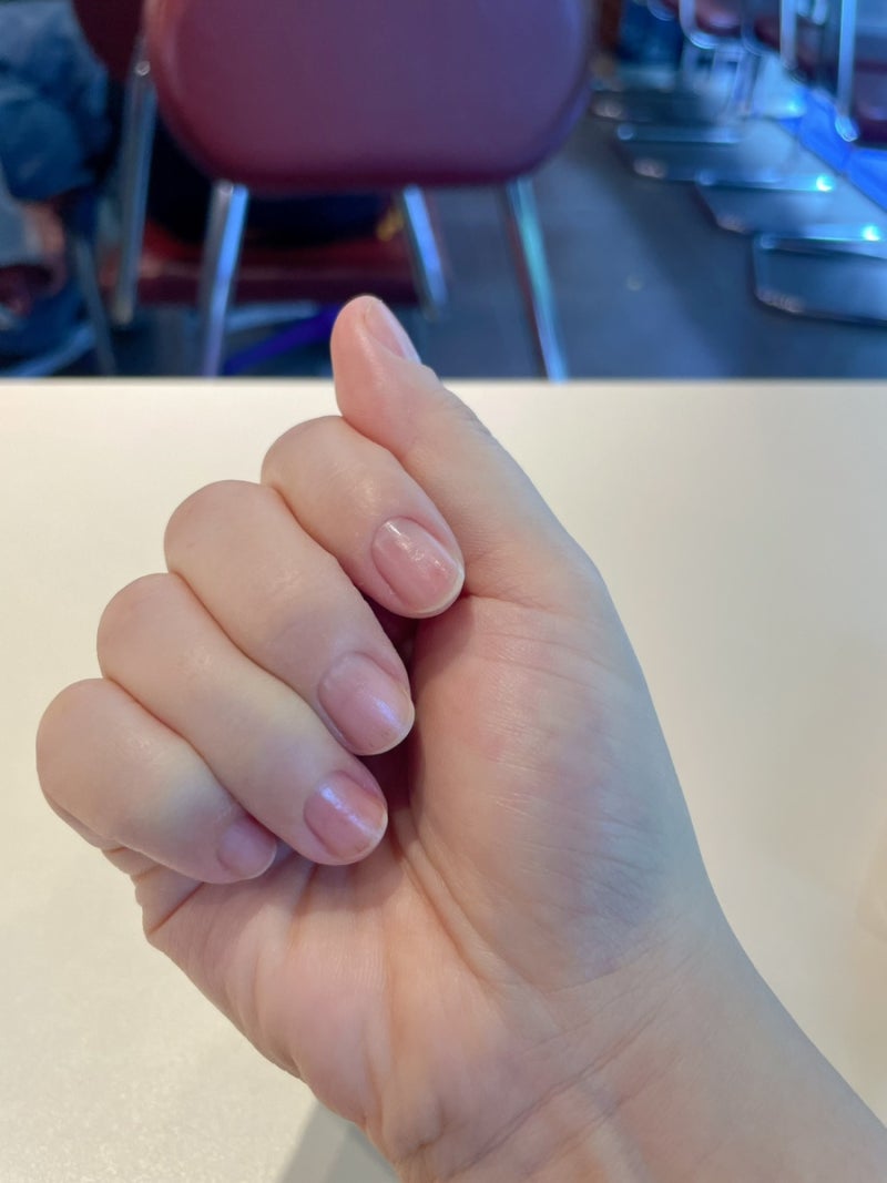선릉역 네일샵 네일에이블 연장제거후 손톱곰팡이 발견