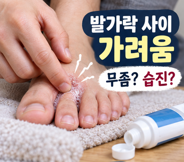 발가락 사이 가려움, 진료 전에 바른 연고 이름도 챙겨야 하는 이유