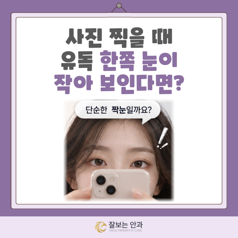 사진 찍을 때 유독 한쪽 눈이 작아 보여요, 단순한 짝눈일까요? | 대구 성형안과 잘보는안과