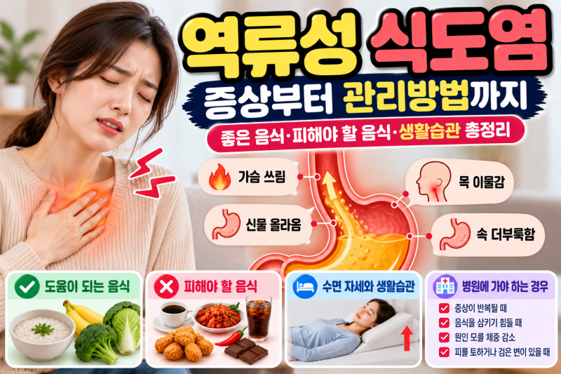 역류성 식도염 증상과 원인｜좋은 음식부터 생활습관까지 총정리