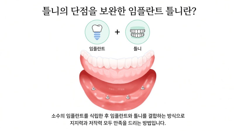 임플란트틀니 비용 지원 건강보험 조건은?