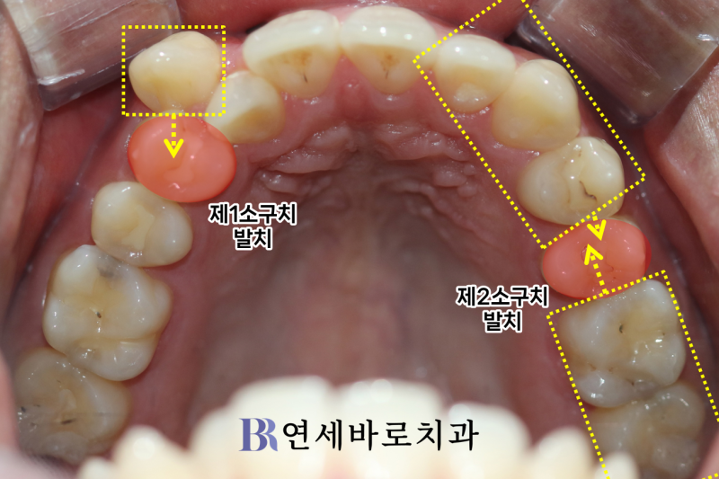대전 둔산동 치과 전문의가 환자 입장이라면?