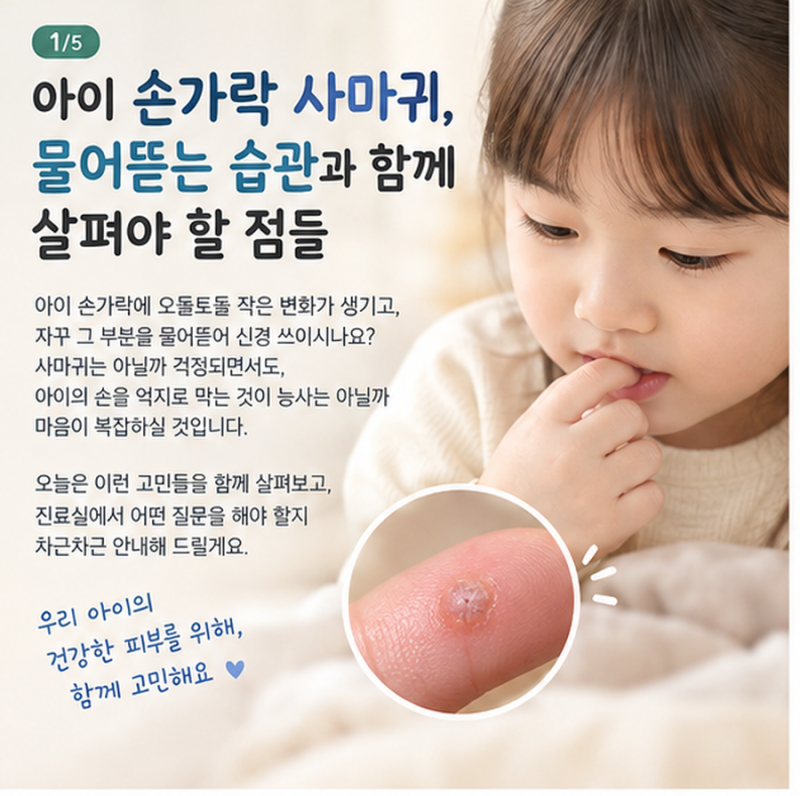 아이 손가락 사마귀, 물어뜯는 습관과 함께 살펴야 할 점들