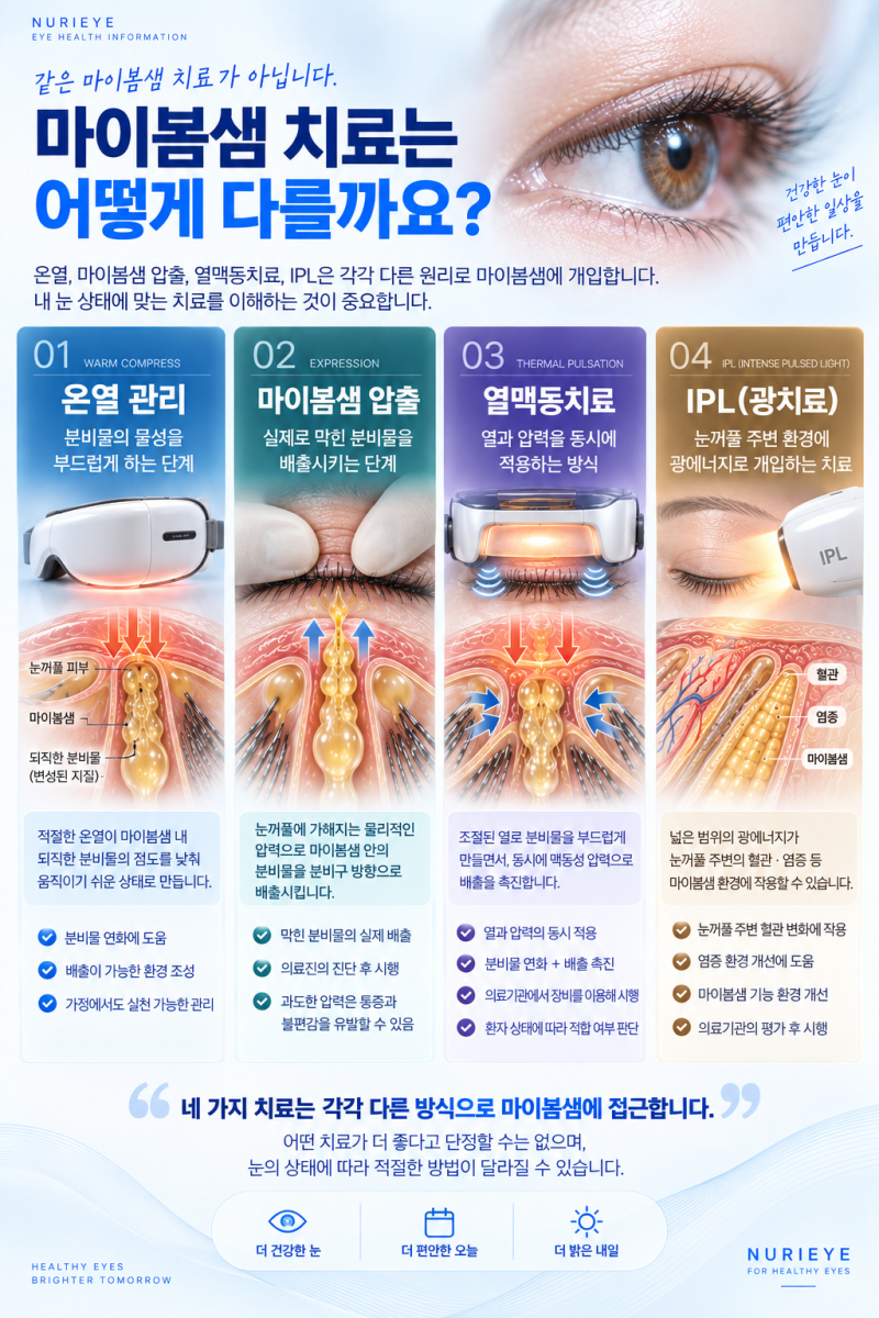 마이봄샘 치료는 어떻게 다를까요? 온열·압출·열맥동치료·IPL 원리 비교