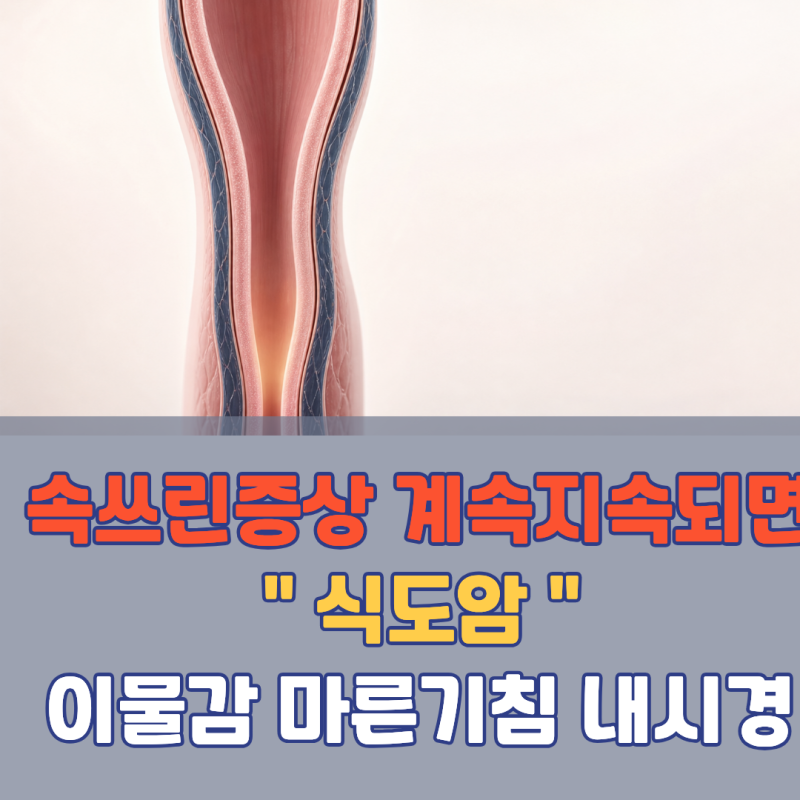 이 쓰린 느낌이 3주 넘게 계속되면 암일 수도 있습니다! 식도암 초기증상 | 역류성 식도염 바....