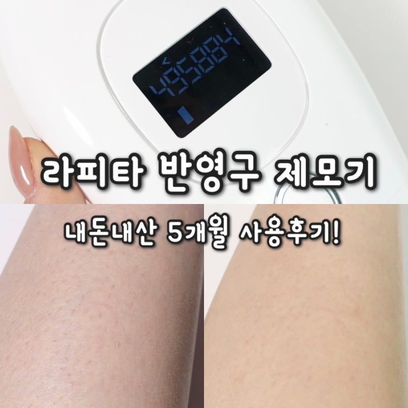 가정용 IPL 제모기 내돈내산 5개월 사용후기! 라피타 글라이딩 오토샷 사용법·장단점, 브라질....