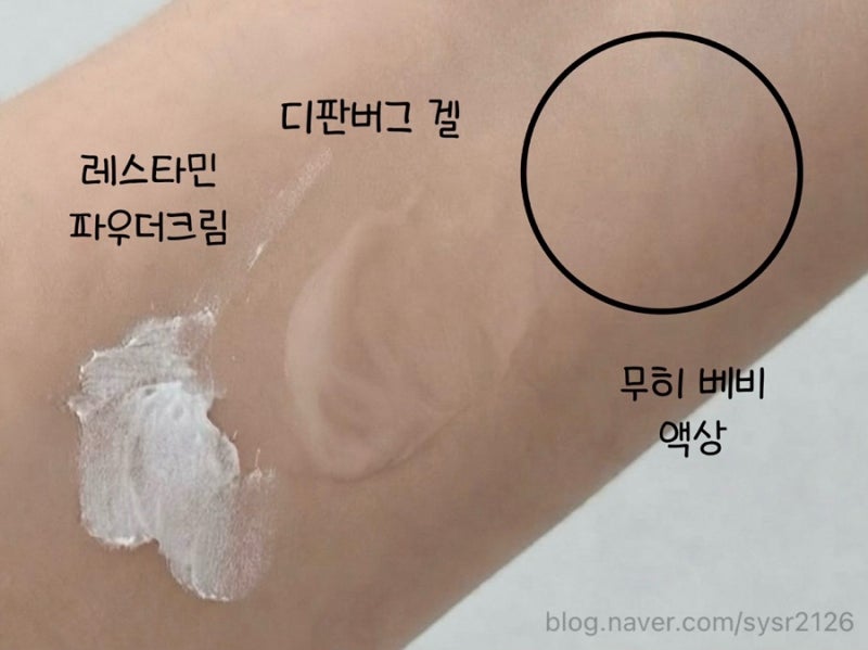 가을 모기 얕보면 안 돼요! 모기 알레르기 있는 아이가 써본 모기약 총정리 (2) - 모기에 물렸....