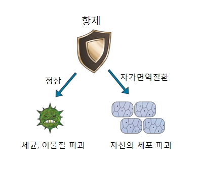 자가면역질환