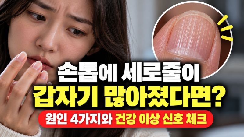 손톱에 세로줄이 갑자기 많아졌다면? 건강 이상 신호일까! 손톱 세로줄 원인 4가지와 단순 노....