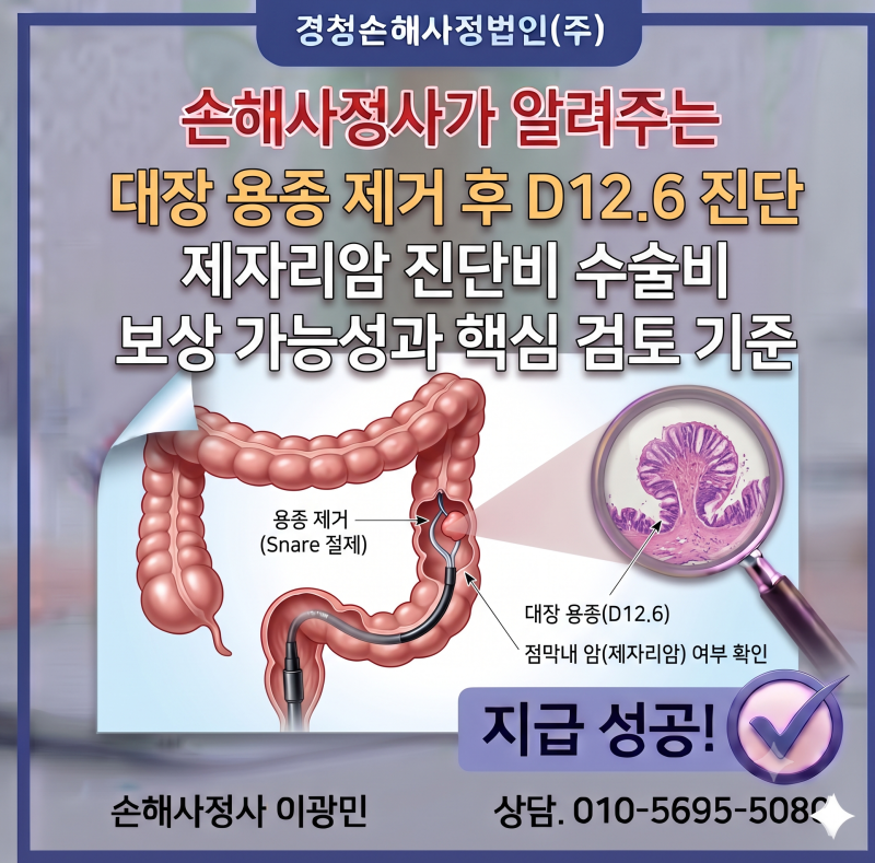 대장 용종 제거 후 D12.6 진단, 제자리암 진단비 및 수술비 보상 가능성과 핵심 검토 기준