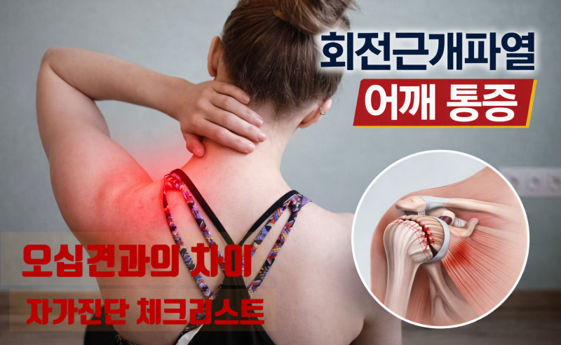 회전근개 파열 증상 오십견 차이점 자가진단 체크리스트 치료법 총정리