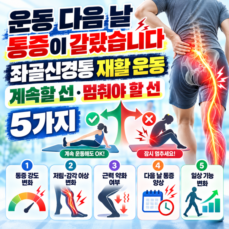 운동 다음 날 통증이 갈랐습니다, 좌골신경통 재활 운동 '계속할 선·멈춰야 할 선' 5가지