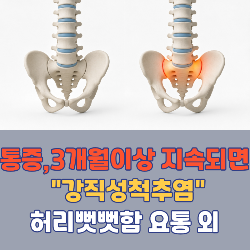 이 통증이 3개월 넘게 계속되면 척추 굳는 병일 수도 있습니다! 강직성 척추염 초기증상 | 아....