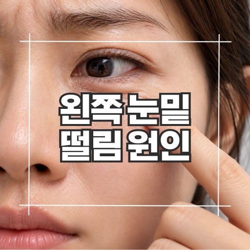 왼쪽 눈밑 떨림 원인, 계속 지속되는 이유는?