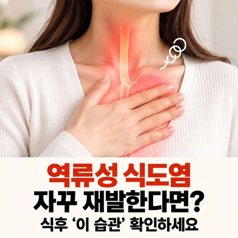 역류성 식도염 자꾸 재발한다면? 식후 '이 습관' 확인하세요