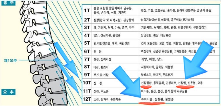 7년차 루푸스 시야 흔들림 치료 원리 설명 2022-1-7 닥터요셉, 자가면역질환 치료