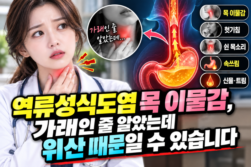 역류성식도염 목 이물감, 가래인 줄 알았는데 위산 때문일 수 있습니다