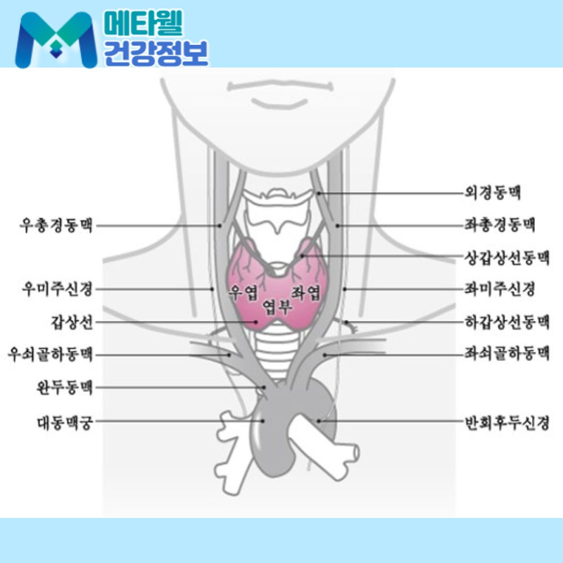 갑상선 물혹, 목에 혹이 있다니 암부터 의심하셨죠? 물로 찬 단순 낭종은 대부분 양성이라 초....