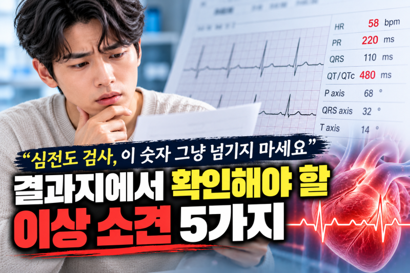 심전도 검사, 이 숫자 그냥 넘기지 마세요 결과지에서 확인해야 할 이상 소견 5가지