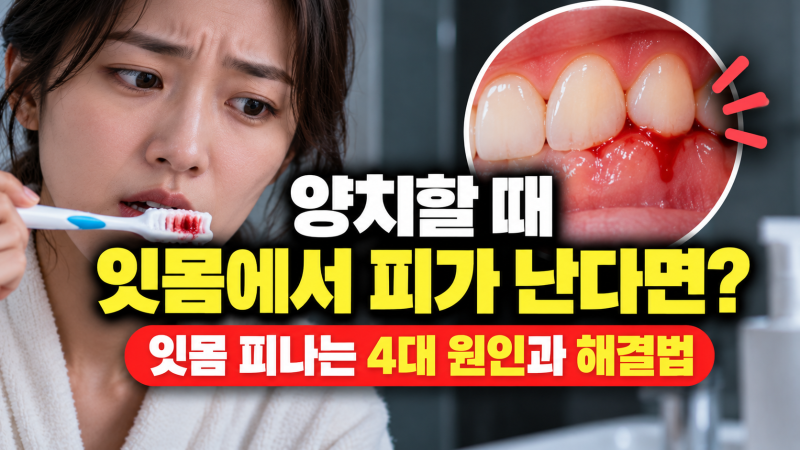 양치할 때 잇몸에서 자꾸 피가 난다면? 칫솔 때문이라고 넘겨도 될까! 잇몸 피나는 4대 진짜 ....