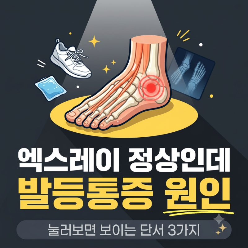 발등통증 원인 4가지, 엑스레이 정상이어도 피로골절일 수 있다