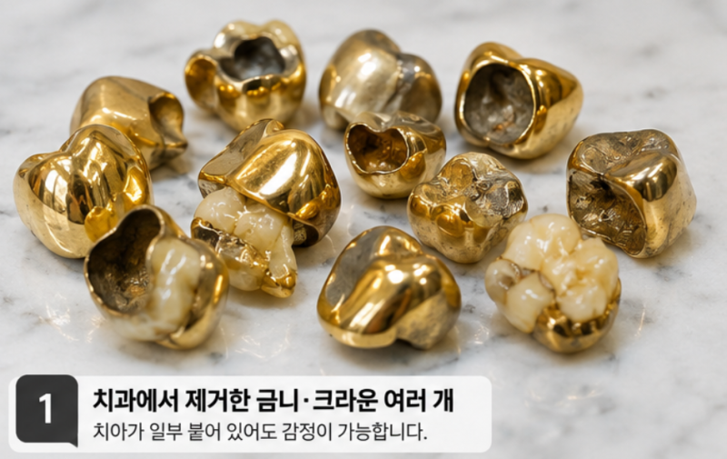 금니 팔아도 될까? 치아 붙은 금이빨부터 크라운·인레이·포세린 가격 차이까지!