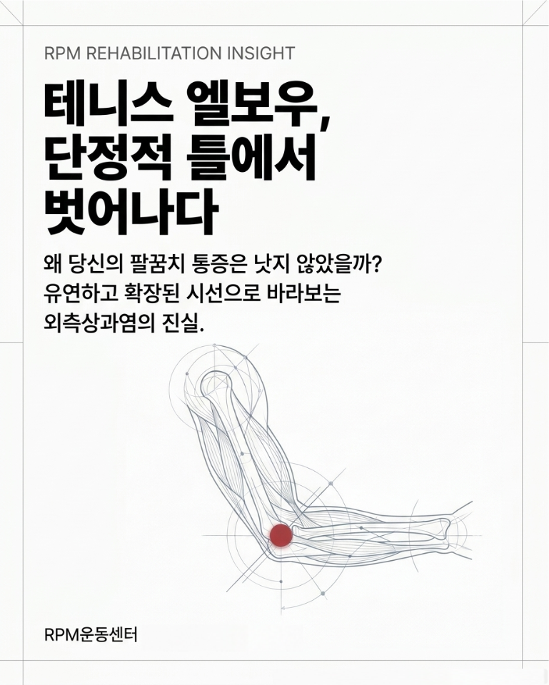 테니스 엘보우, 단순한 염증이 아닙니다｜팔꿈치 외측 통증의 원인과 재활 운동