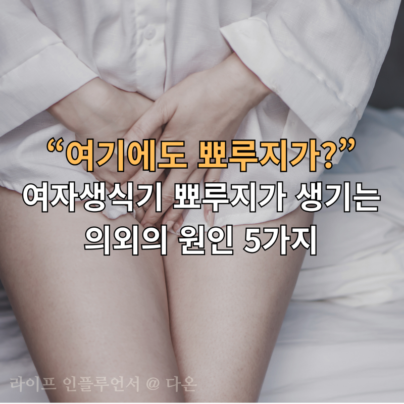 “여기에도 뾰루지가?” 여자생식기 뾰루지가 생기는 의외의 원인 5가지