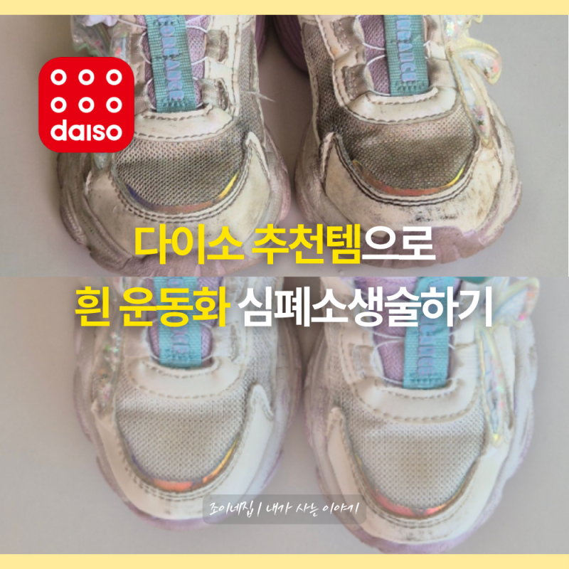 시커먼 운동화 버릴뻔 했는데... 다이소에서 찾은 1000원짜리 세탁템으로 흰 운동화 살려냈어....