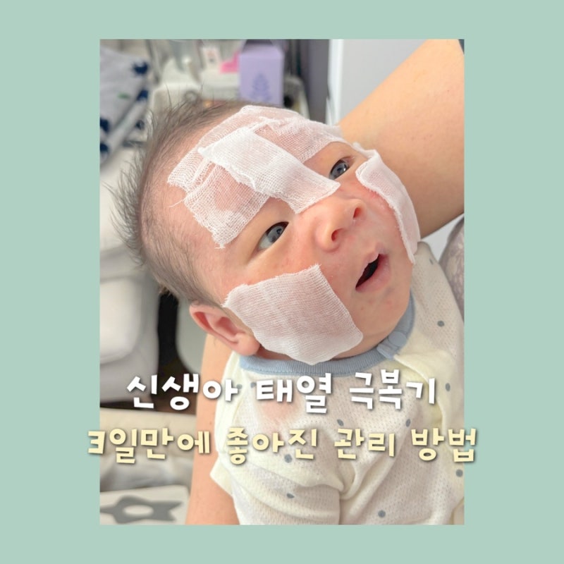 신생아 태열 관리 | 3일만에 좋아진 방법 3가지 • 앰플팩 수딩젤 보습